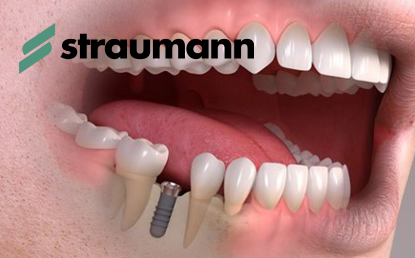 Implantologia Straumann®